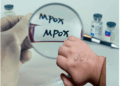 Mpox